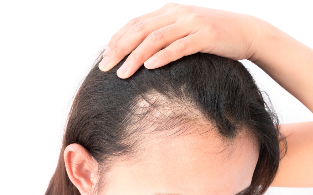 rednutia vlasov príčiny